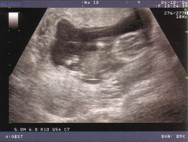 2006.10.04 echo4.jpg